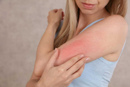 What Type of Soap Works Best for Sensitive Skin?